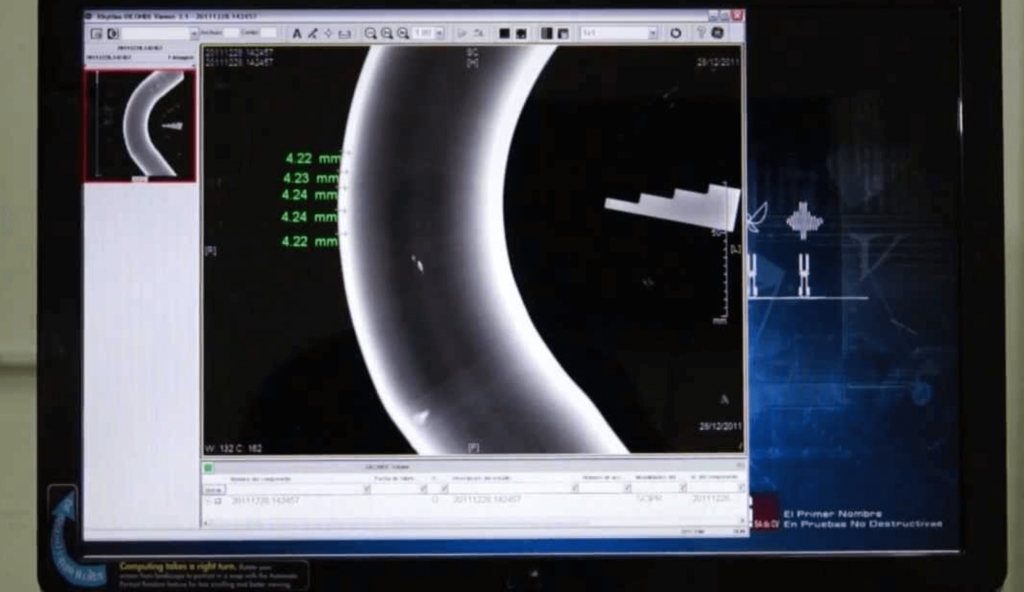 capacitacion sobre Radiografia digital